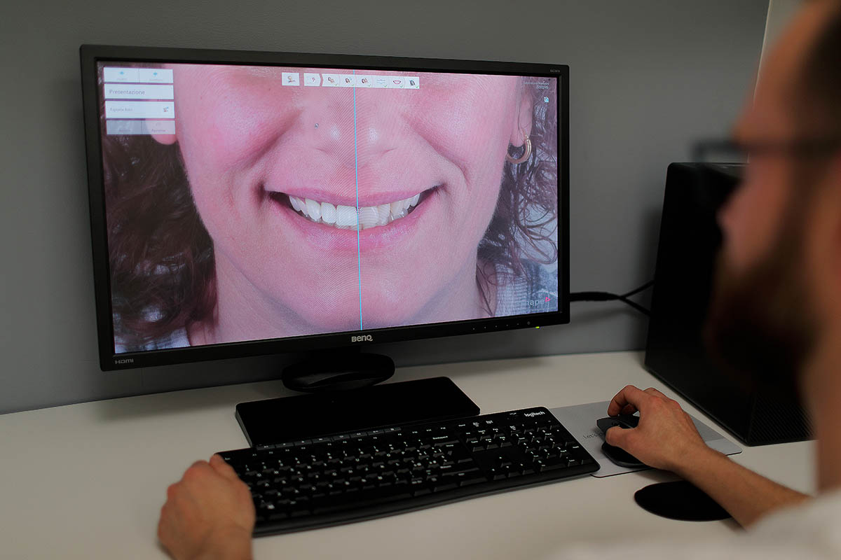 Dentista digitale e il futuro dell’odontoiatria